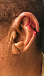 Facial Trauma/Skin Cancer