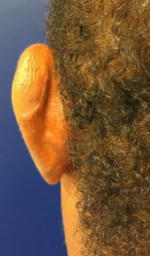 Facial Trauma/Skin Cancer