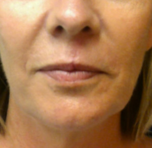 Facial Trauma/Skin Cancer