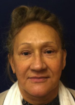 Non-Surgical