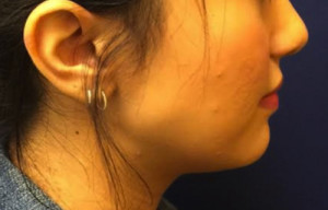 Non-Surgical