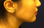 Non-Surgical