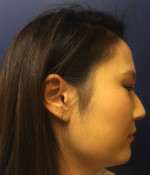 Non-Surgical