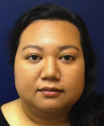 Facial Trauma/Skin Cancer