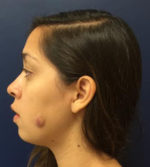 Facial Trauma/Skin Cancer