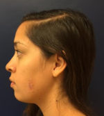 Facial Trauma/Skin Cancer