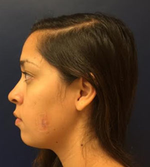 Facial Trauma/Skin Cancer