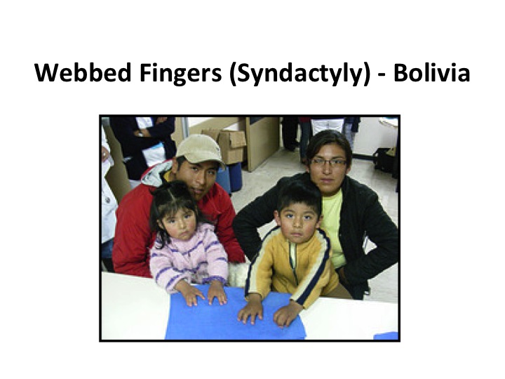 Webb Fingers Bolivia