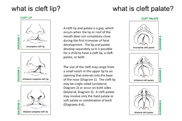Cleft Lip/Cleft Palate Procedures